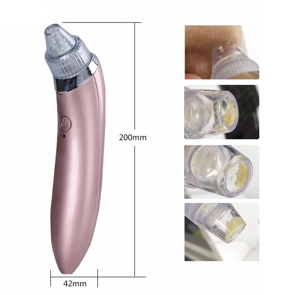 Professional Extracteur de points noirs pour aspirateur pour soins du visage - X10 Maroc - Livraison gratuite -