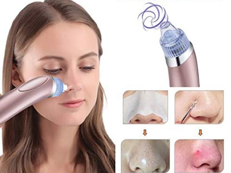 Professional Extracteur de points noirs pour aspirateur pour soins du visage - X10 Maroc - Livraison gratuite -