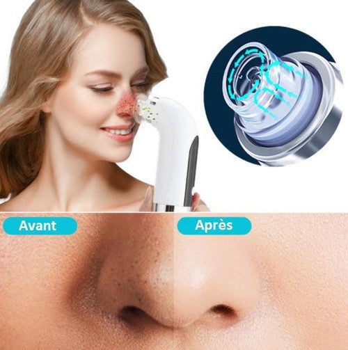 Nettoyant pour le visage et dissolvant de points noirs - X10 Maroc - Livraison gratuite -